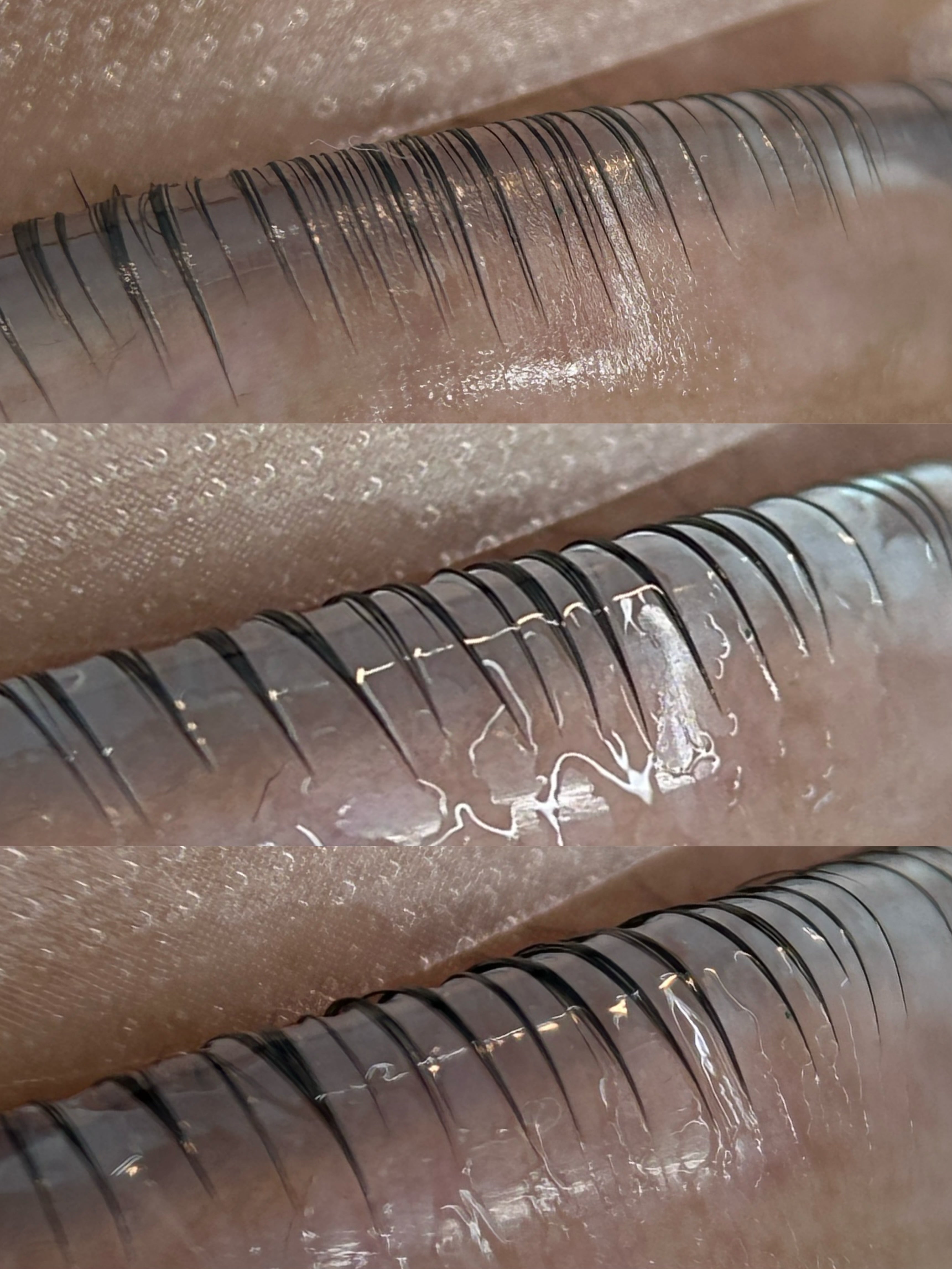 フィルトックス3.0 – NewYorkNaIL